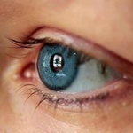 Bright Eyes Iris Color Change Surgery
