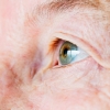 All About Cataract Surgery in Nashua